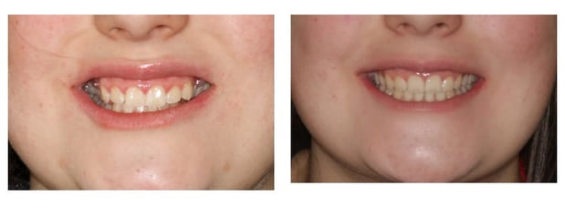 Images Aspen Ridge Dental