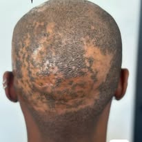 Images The Scalp Master