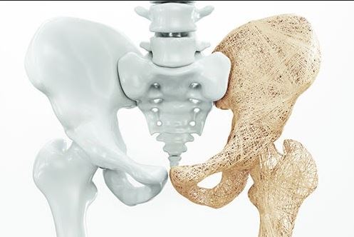 Georgia Bone and Joint Osteoporosis