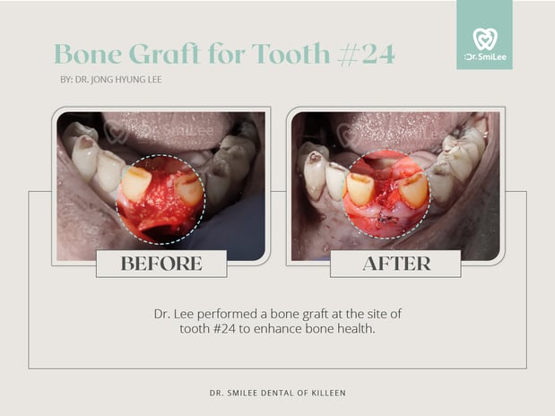 Images Dr Smilee Dental of Killeen, Family, Cosmetic, Implant, Medspa