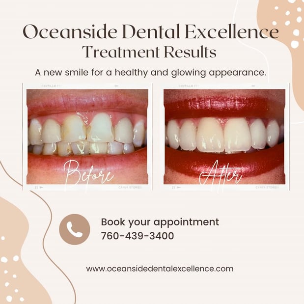 Images Oceanside Dental Excellence