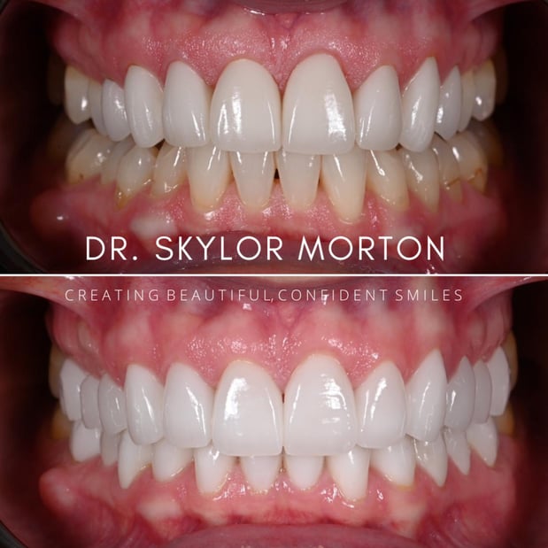 Images Nashville Wisdom Teeth and Implant Solutions