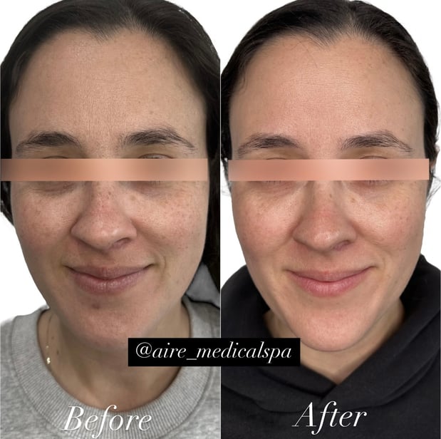 Images Aire Medical Spa