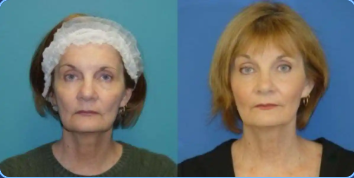 Bluewater Plastic Surgery Image