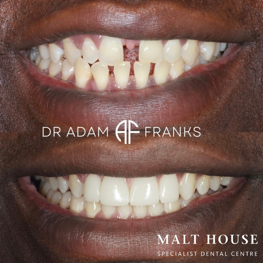 Images Malt House Specialist Dental Centre