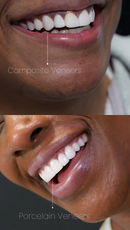 Images Gables iSmile