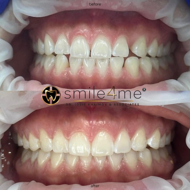 Images smile4me Dental Care - Astoria, Queens