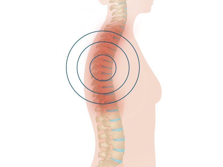Cncrns_Cndtns-backpain-middle-392x294_@2x.jpg
