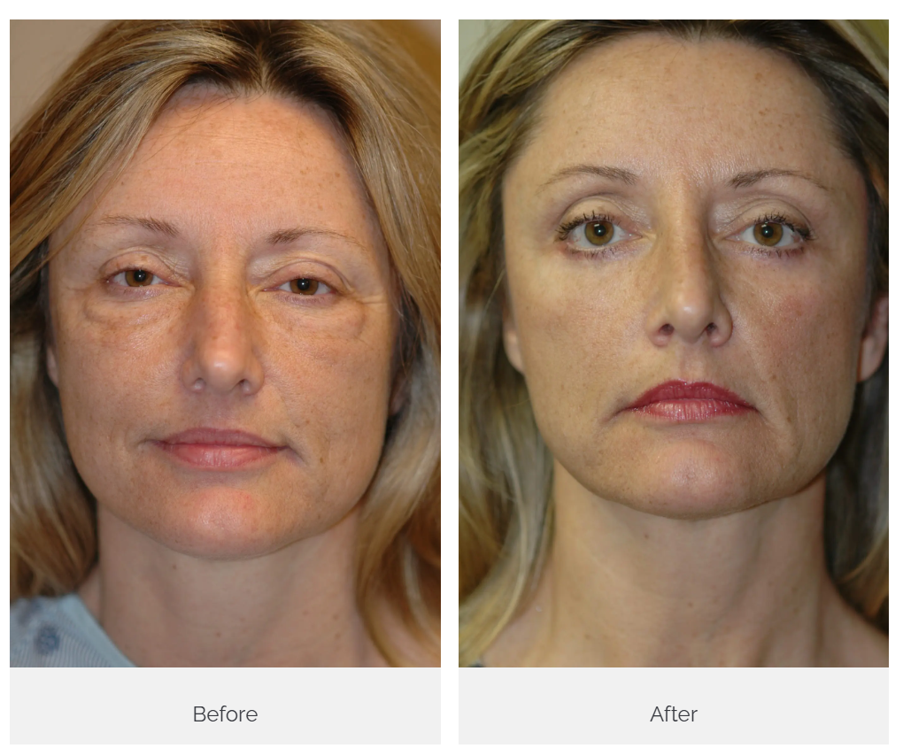Castellano Cosmetic Surgery Center Image