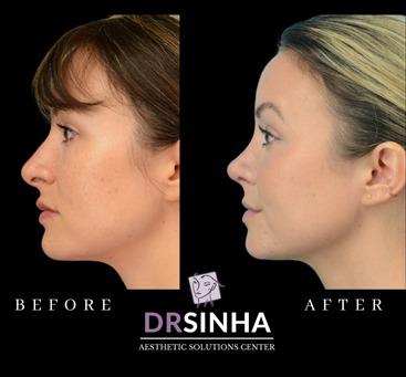Images Pradeep K Sinha MD PhD FACS - Facial Aesthetic Surgery