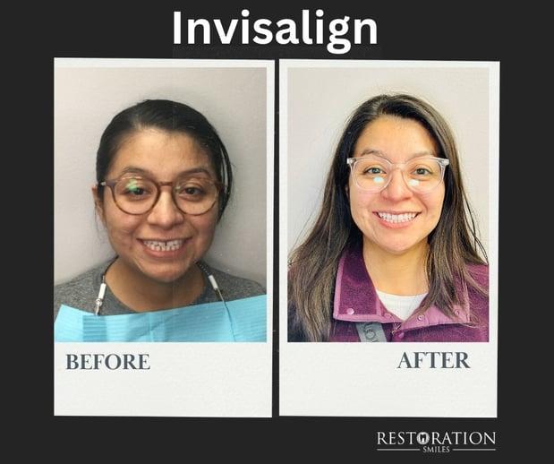 Images Restoration Smiles - Dentist Tomball