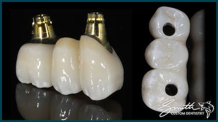 Images Smith Custom Dentistry