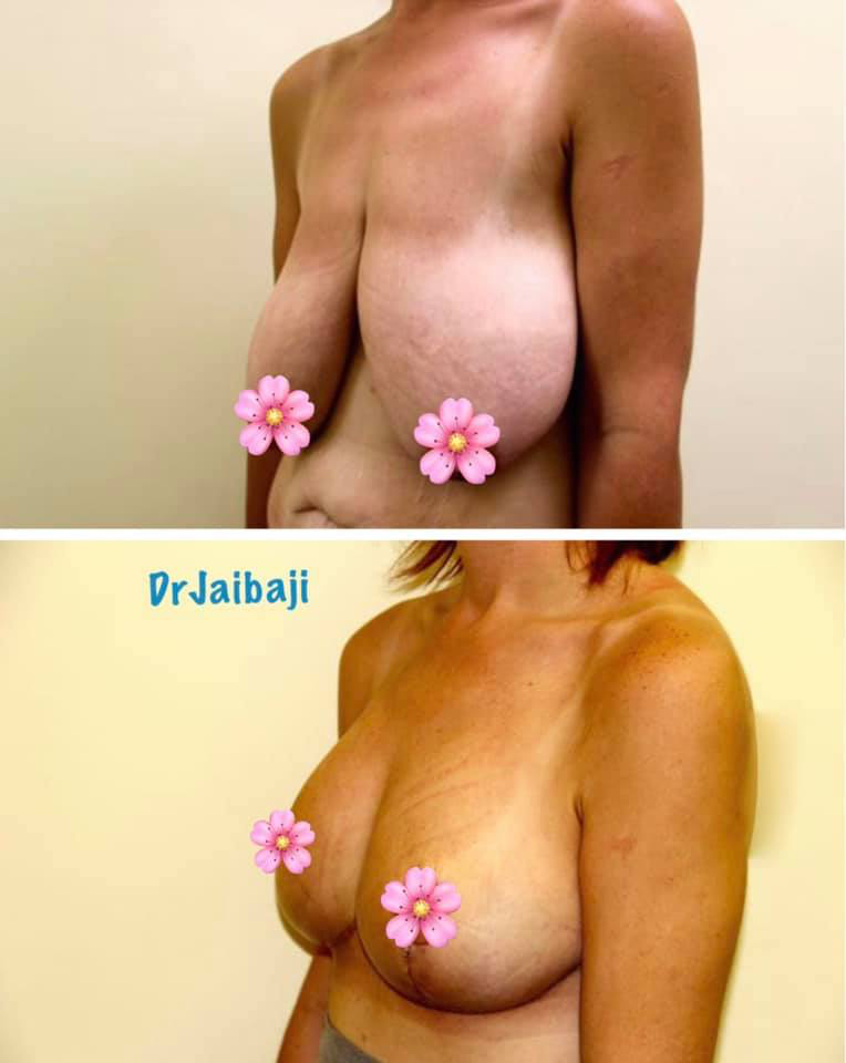 Jaibaji Plastic Surgery Photo