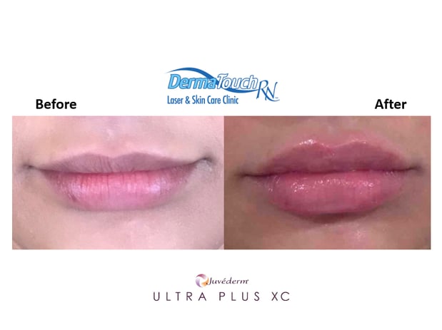 Images DermaTouch RN