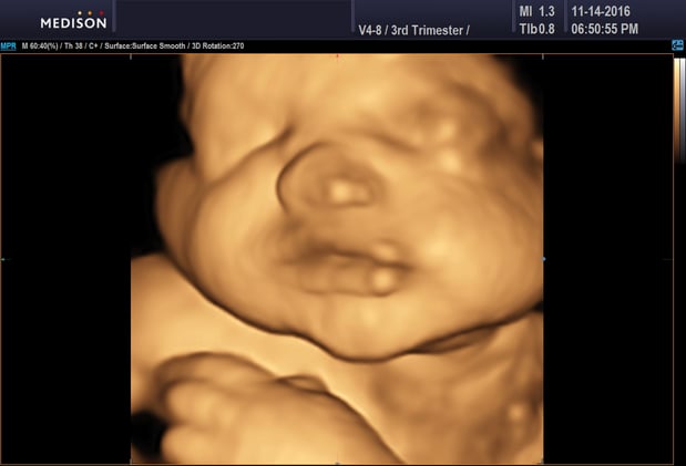 Images Heavenly 3D 4D Ultrasounds
