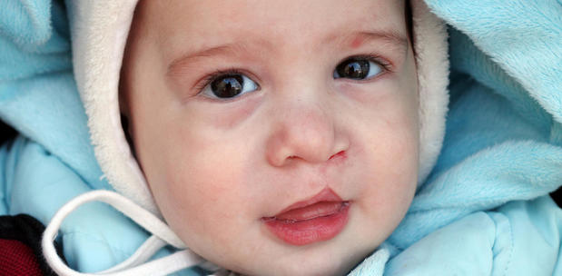 Images Cook Children's Craniofacial and Cleft Surgery