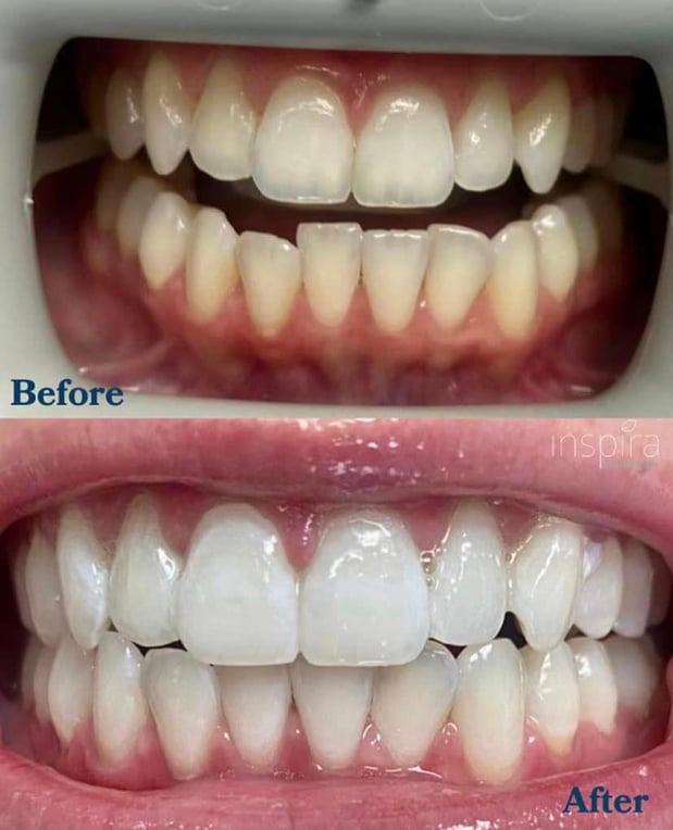 Images Inspira Dental Care