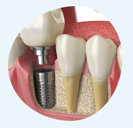 Zahnarztpraxis Dr. Indra Nyamaa, Mutschellestr. 1 in München