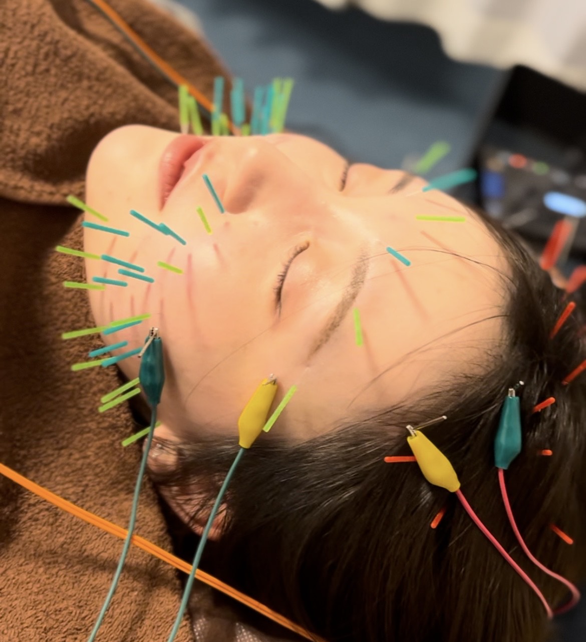 Images 鍼処MINAOSHI