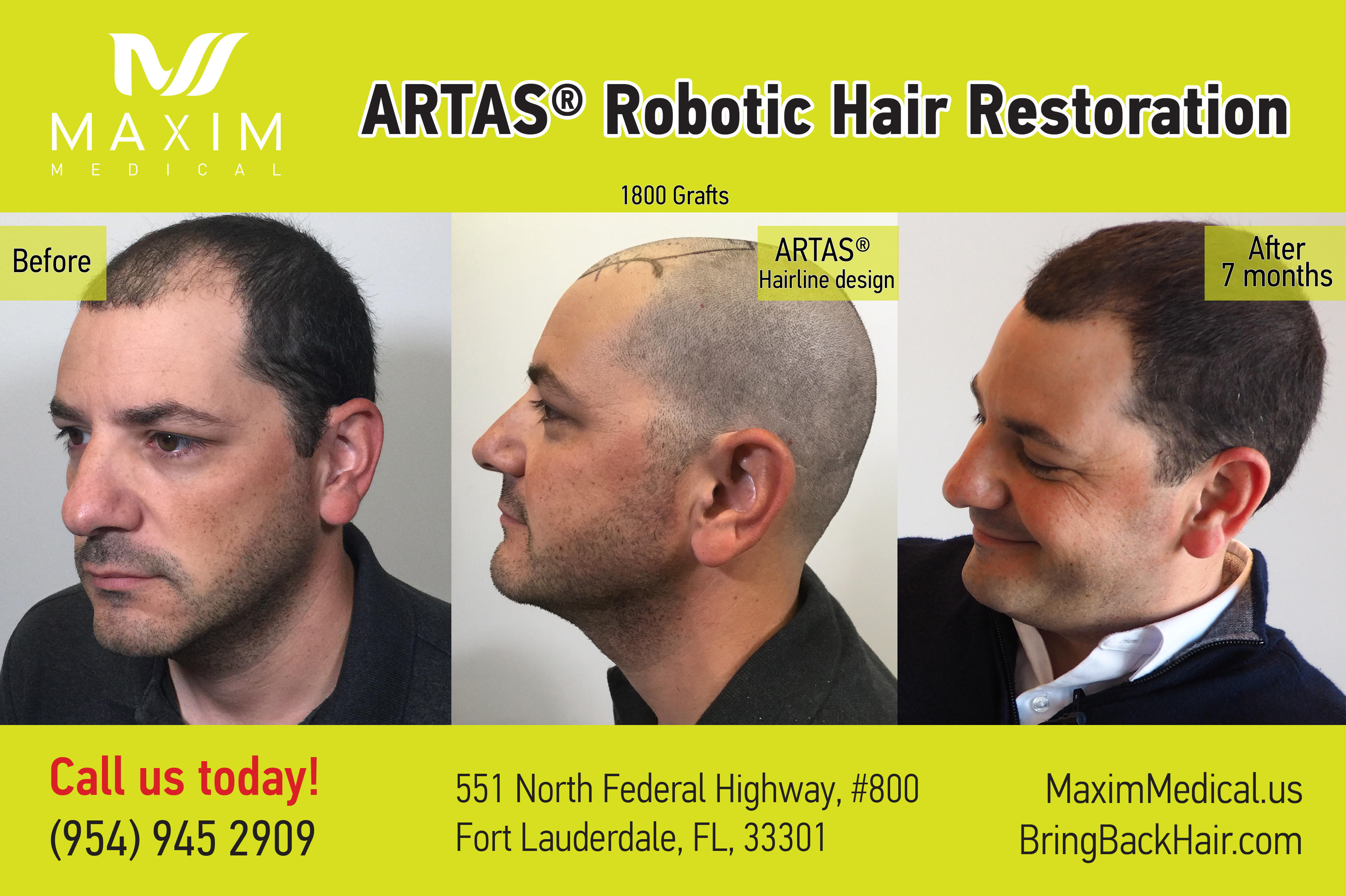 MAXIM MEDICAL, Robotic Hair Transplant Clinic Photo