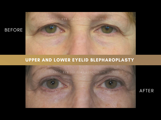 Images Plastic Eye Surgery Associates, PLLC