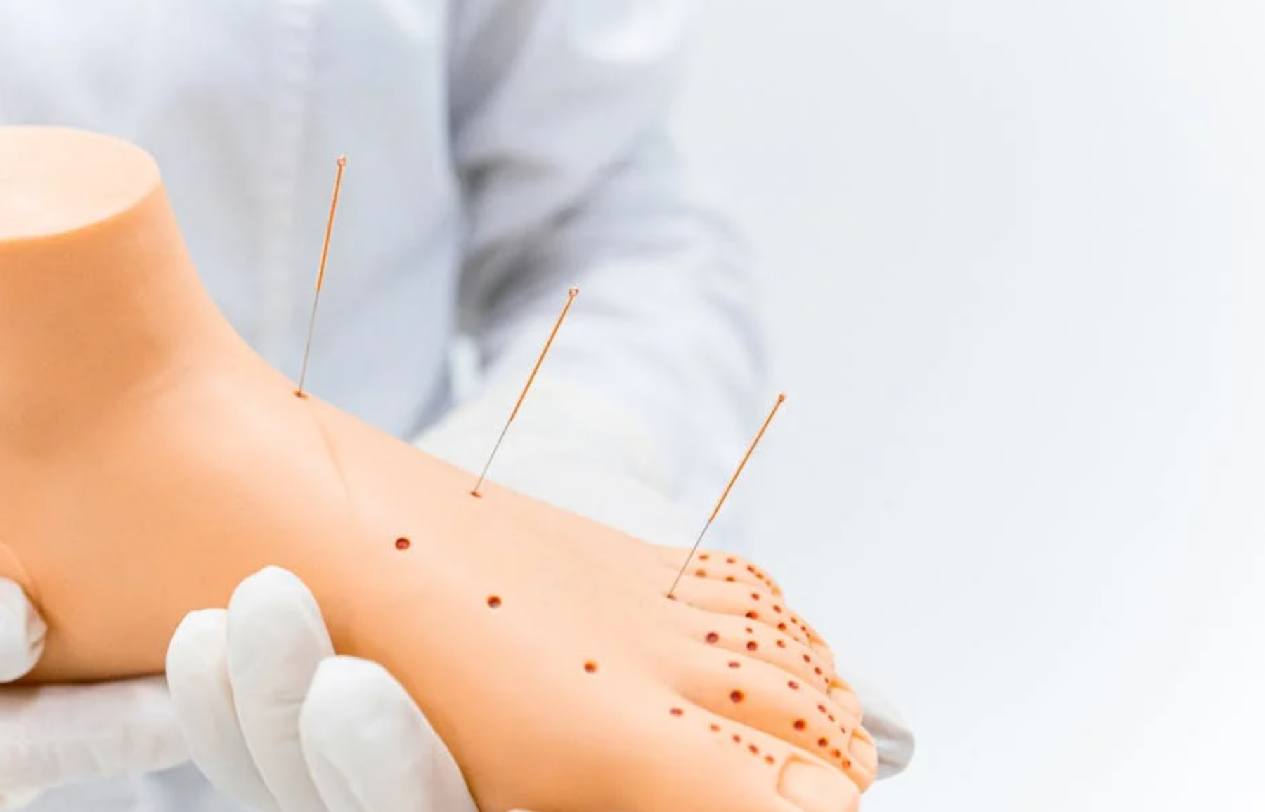 Images Acupuntura vital majadahonda