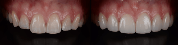 Images Jeppson Dental
