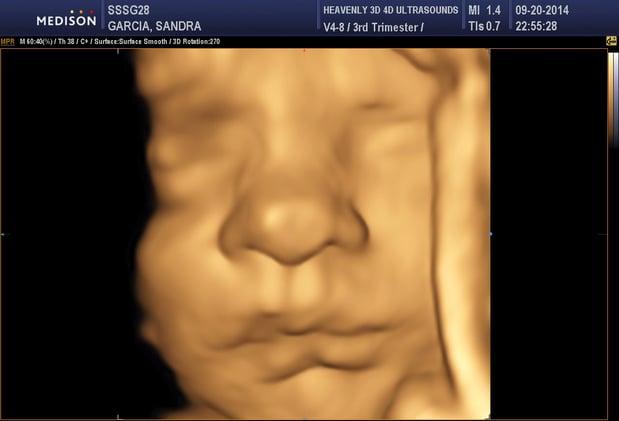 Images Heavenly 3D 4D Ultrasounds-Upland