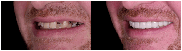 Images Jeppson Dental