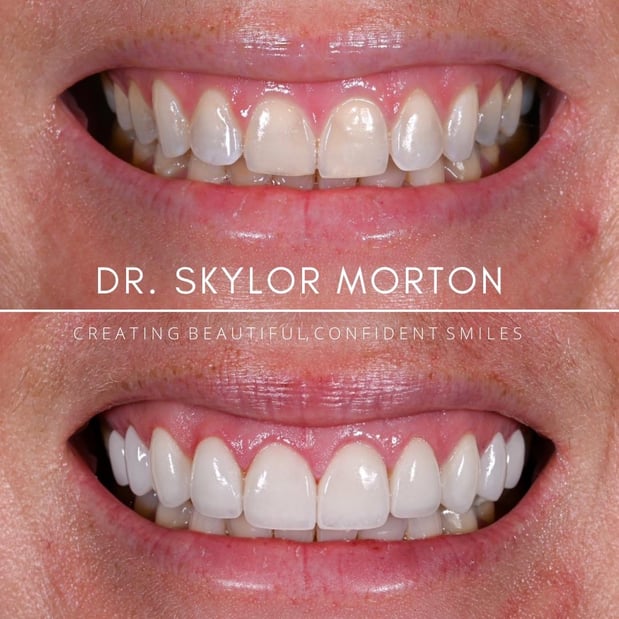Images Nashville Wisdom Teeth and Implant Solutions