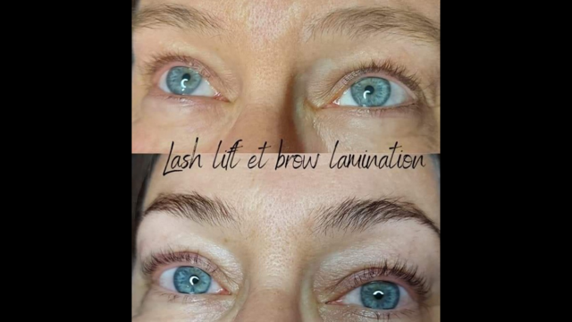 Images Onyx Esthétique - Soins esthétiques, Soins de la peau, Laser Cynosure Gatineau