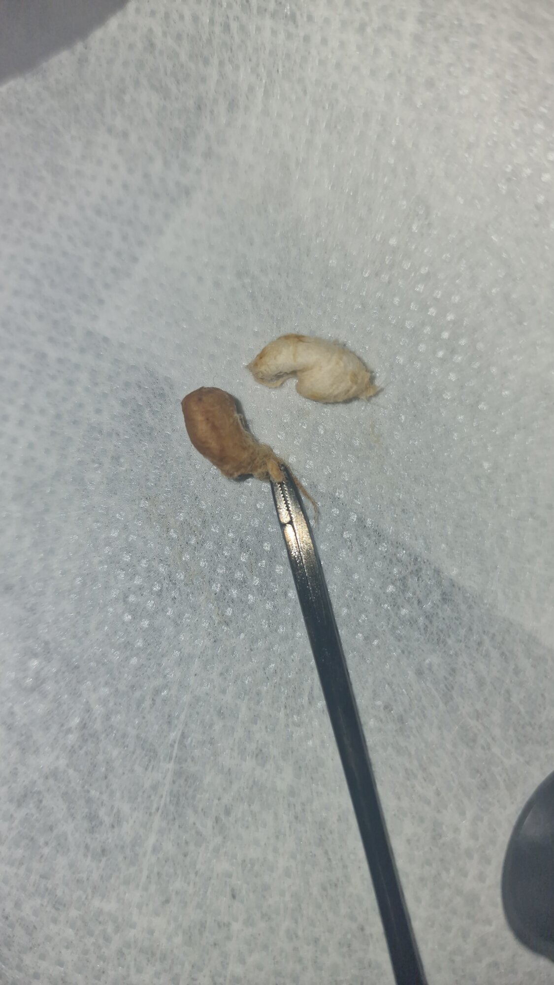 Images MW Ear Wax Removal
