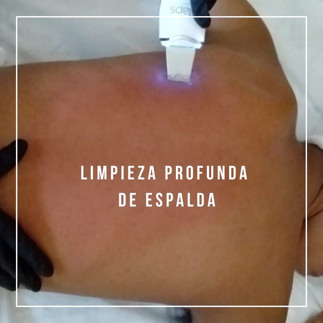 Images Surur Belleza