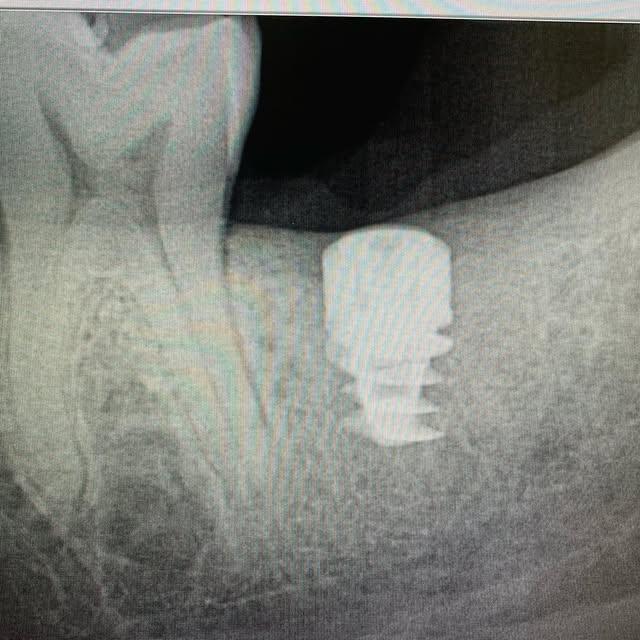 Images Smiles By Eddie: Dr. Edmond Ahdoot DDS