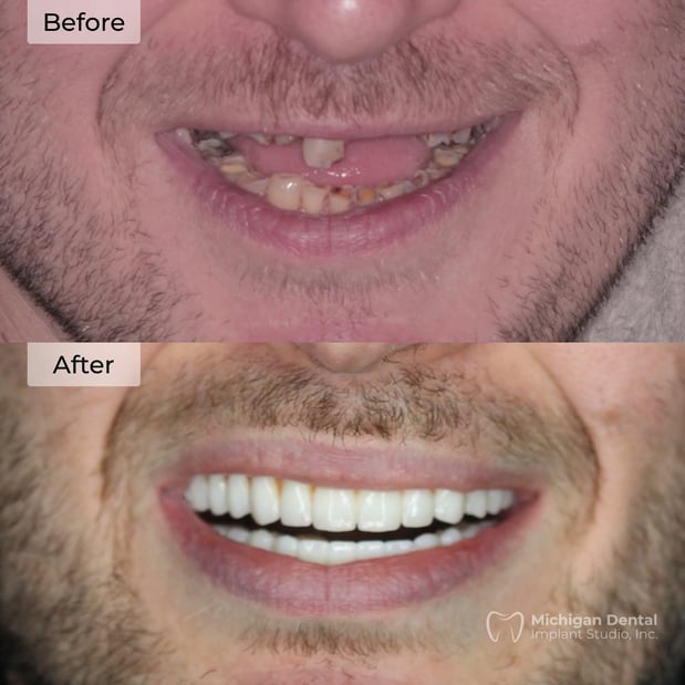Images Michigan Dental Implant Studio