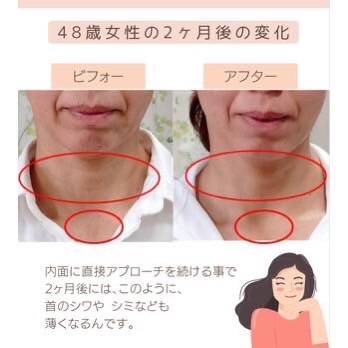 Images 目元・口元のたるみ&眉間シワ改善専門サロン