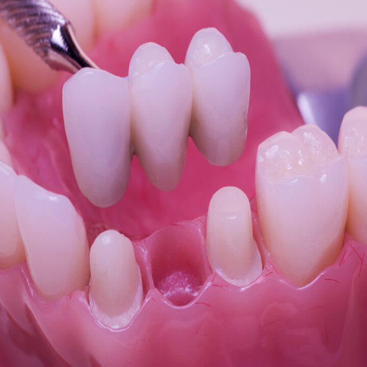 Images My Care Dental