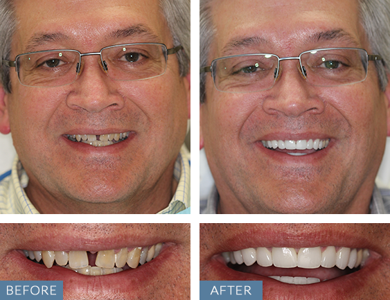 Images Almeida & Bell Dental Lone Tree - General, Cosmetic, and Implant Dentistry