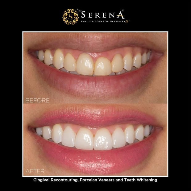 Images Serena San Diego Dentist