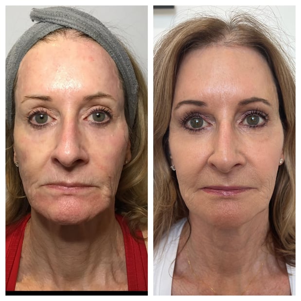 Images Body Lounge Park Cities - Whole Body Wellness & Medical Aesthetics, Dallas, TX