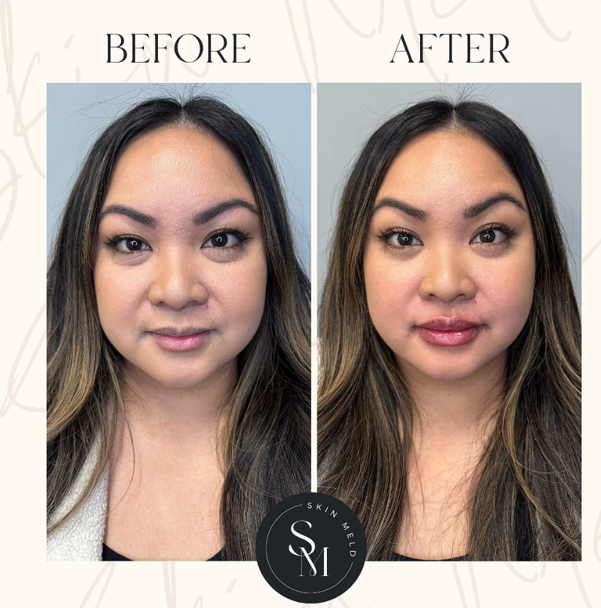 Skin Meld Injectables and Wellness Logo