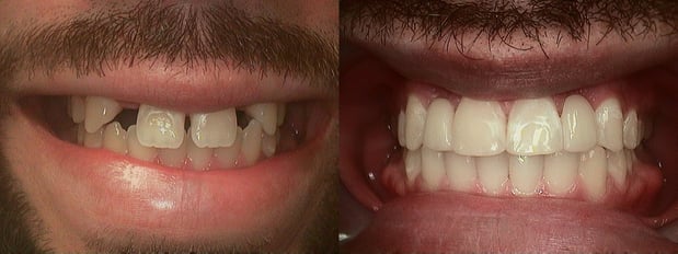 Images Complete Dental Health