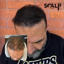 Images The Scalp Master