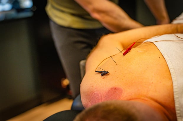 Images The Performance Project | Physical Therapy and Sports Performance