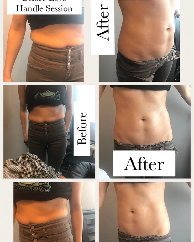Images Queen Divas Body Sculpting