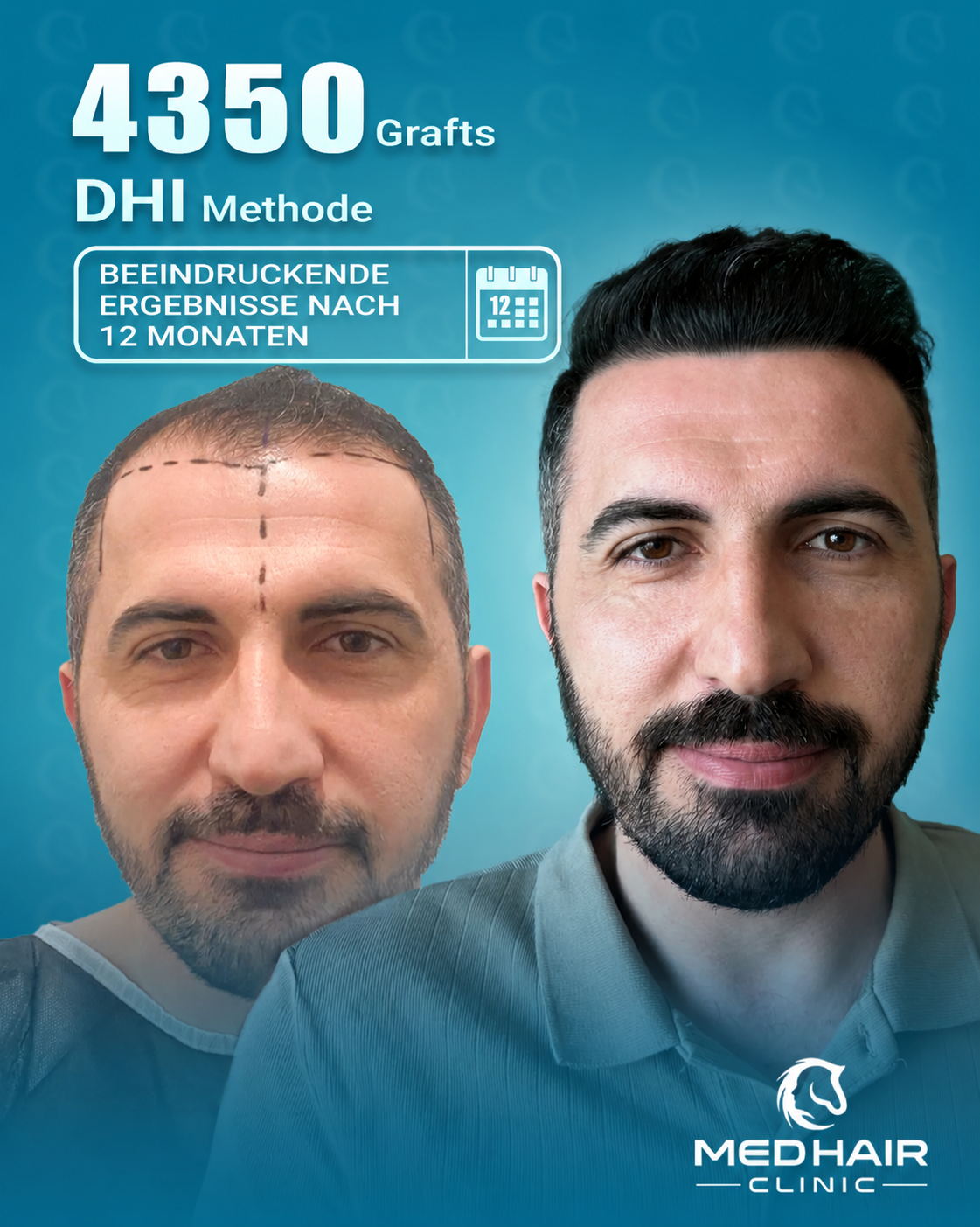 MedHair Clinic | Niederlassung Berlin | Haartransplantation Türkei, Silvio Meier Strasse 2 in Berlin