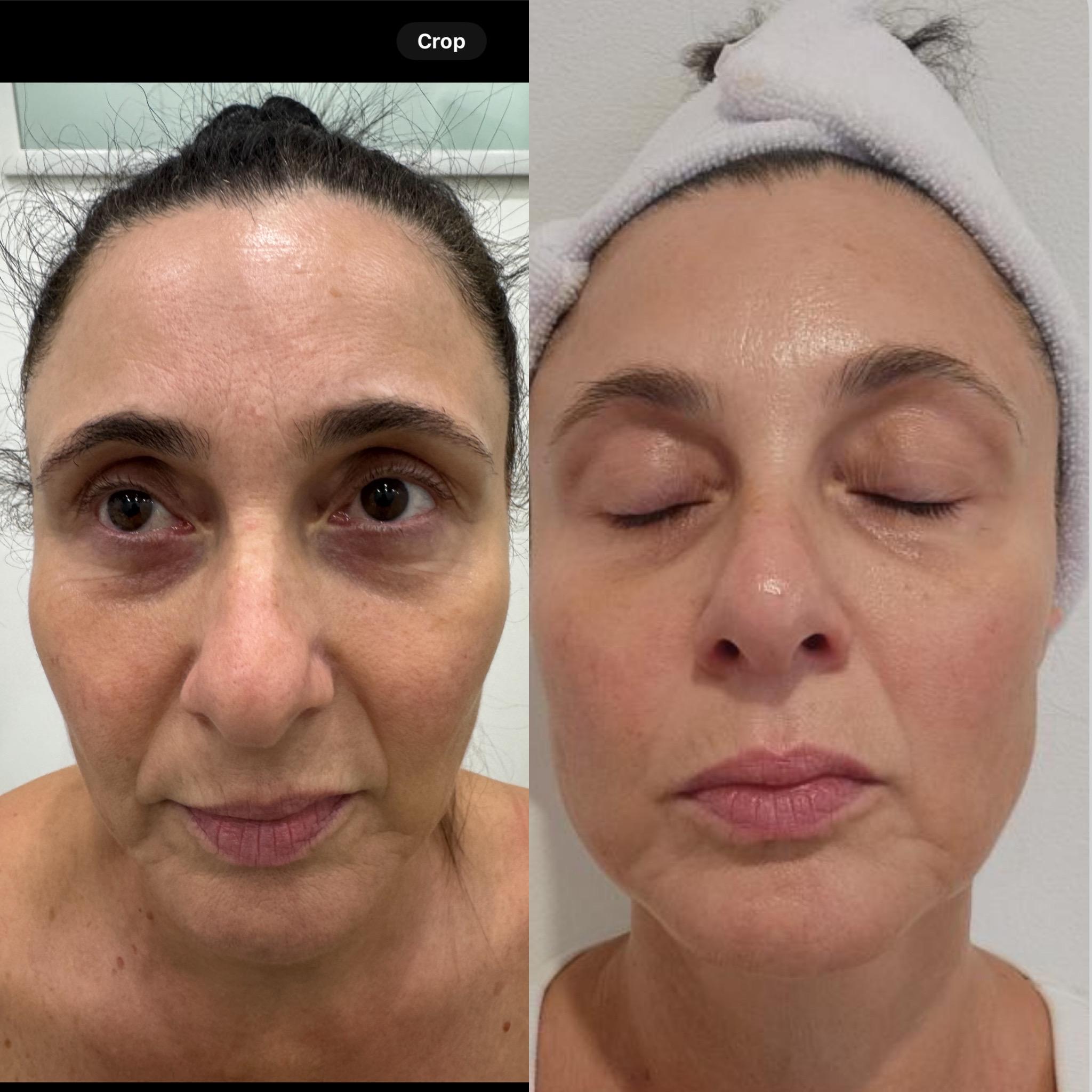 Images Luminous Skin