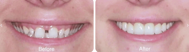 Images Northpointe Smiles