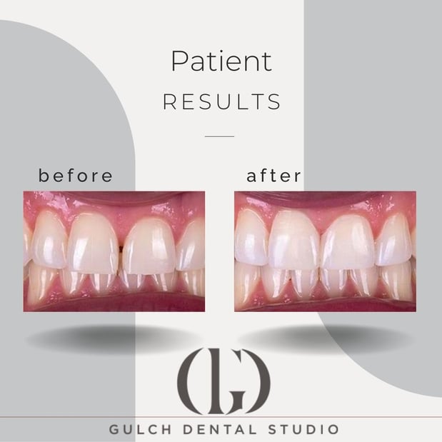 Images Gulch Dental Studio