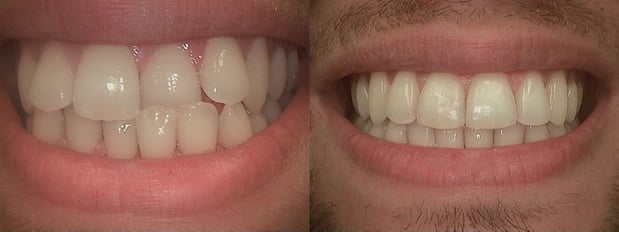 Images Complete Dental Health